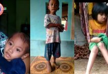 Anak Anak Butuh Bantuan Uluran Tangan Dinas Kabupaten Bogor