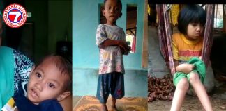 Anak Anak Butuh Bantuan Uluran Tangan Dinas Kabupaten Bogor