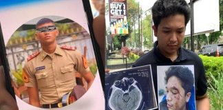 Terulang, Mirip Kasus Kekerasan Mario Dandy, Kekerasan Anak Petinggi Polresta Deli Serdang dengan Mahasiswa Kedokteran