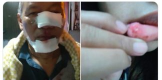 Viral!!! Aksi kekerasan oleh Komunitas Di Bogor, Korban alami Luka di Wajah.
